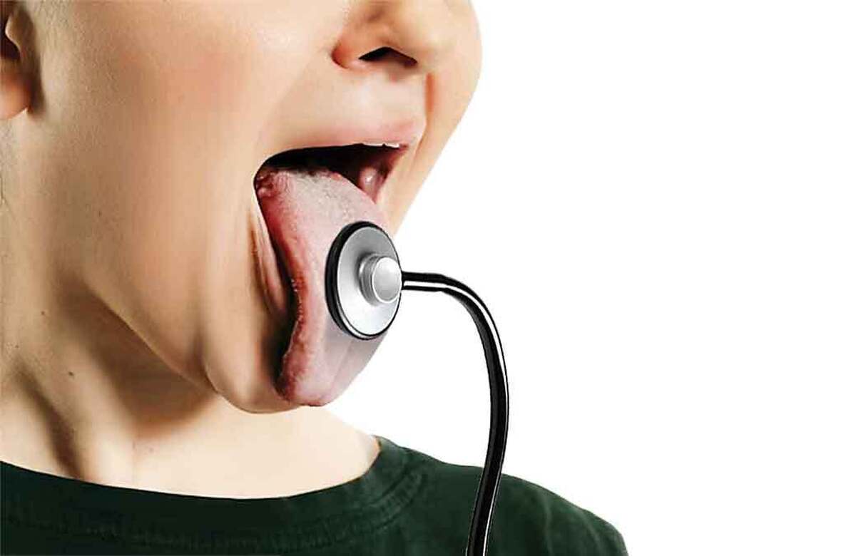 نشانه‌های مهمی که رنگ زبان درباره سلامتی دارد