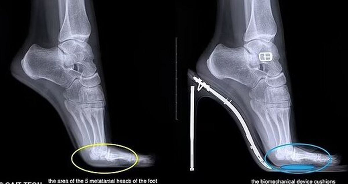 مشکل بانوان برای استفاده از کفش پاشنه بلند حل شد !