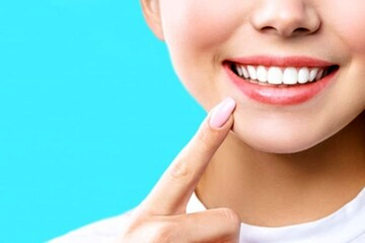 با انواع تغییر رنگ دندان آشنا شوید  چگونه می توانیم دندان های سفید داشته باشیم؟