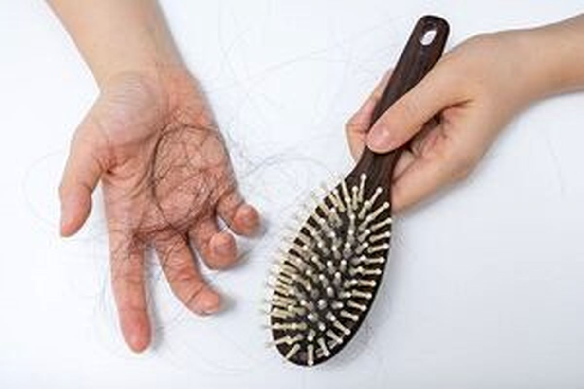 روش‌های پیشگیرانه ریزش مو کدامند ؟
