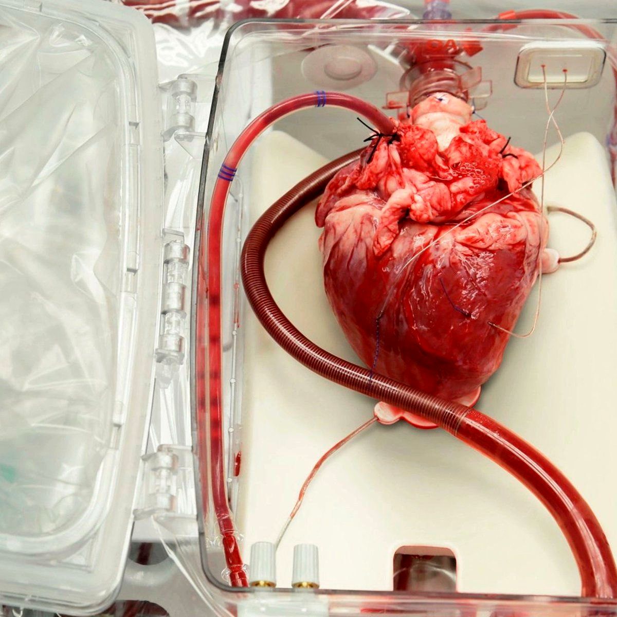 تصویر قلب پیوندی قبل از گذاشتن در بدن بیمار پربازدید شد