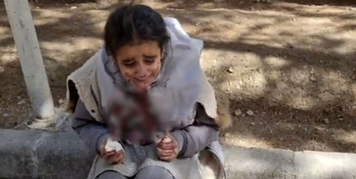 تصویر دردناک دختر خردسال با صورت خونی | این حادثه چگونه اتفاق افتاد؟