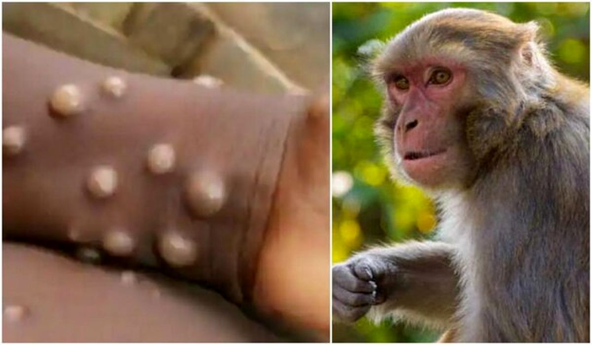 میزان اثرگذاری واکسن آبله بر "آبله میمونی"