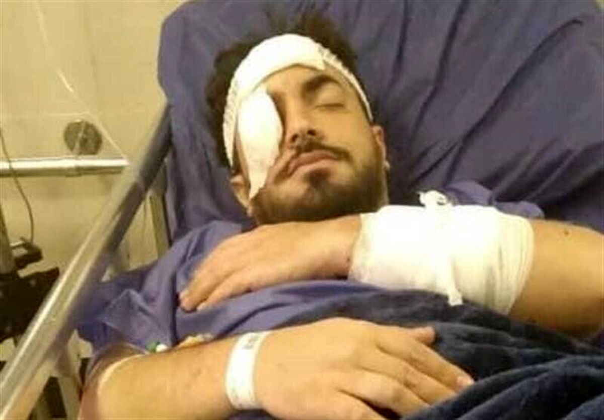 پیاده‌روی در منطقه تهرانپارس با قمه‌کشی پایان یافت؛ ضرب و جرح یک روحانی