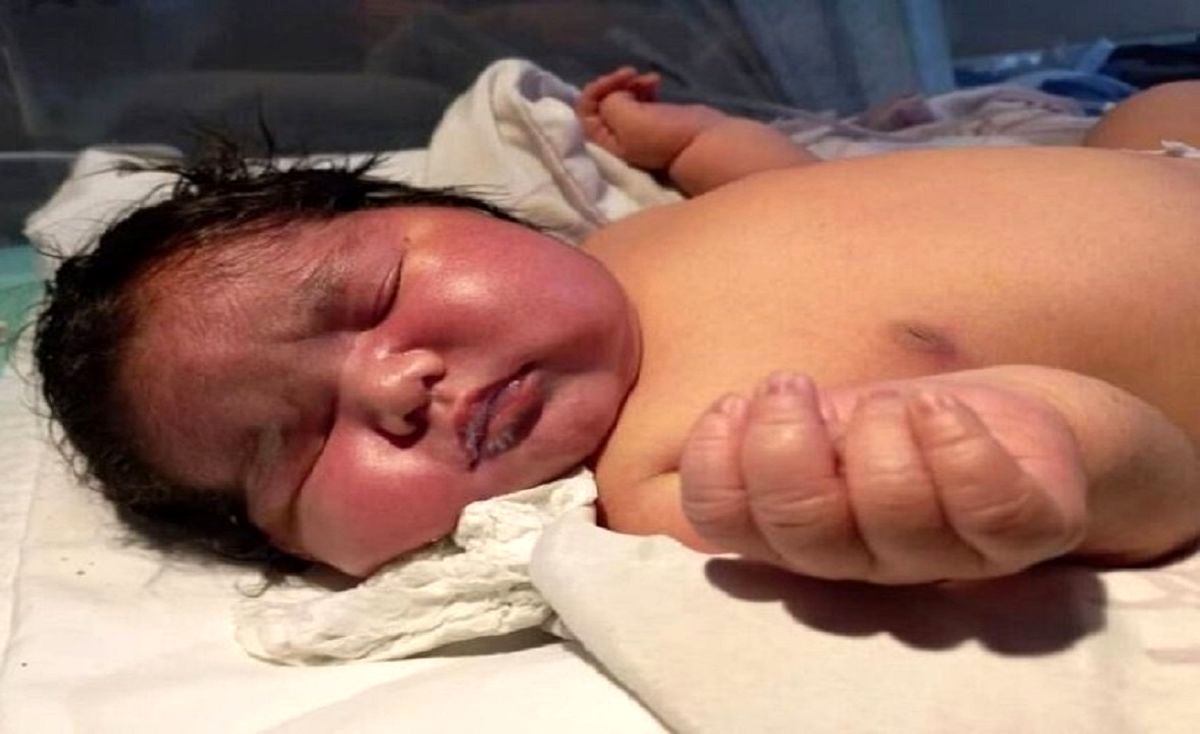 تولد نوزاد دم‌دار در مکزیک +عکس