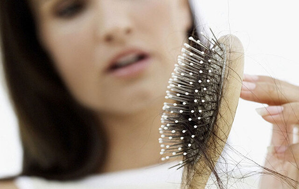 علل ریزش مو در زنان + راه‌های درمان