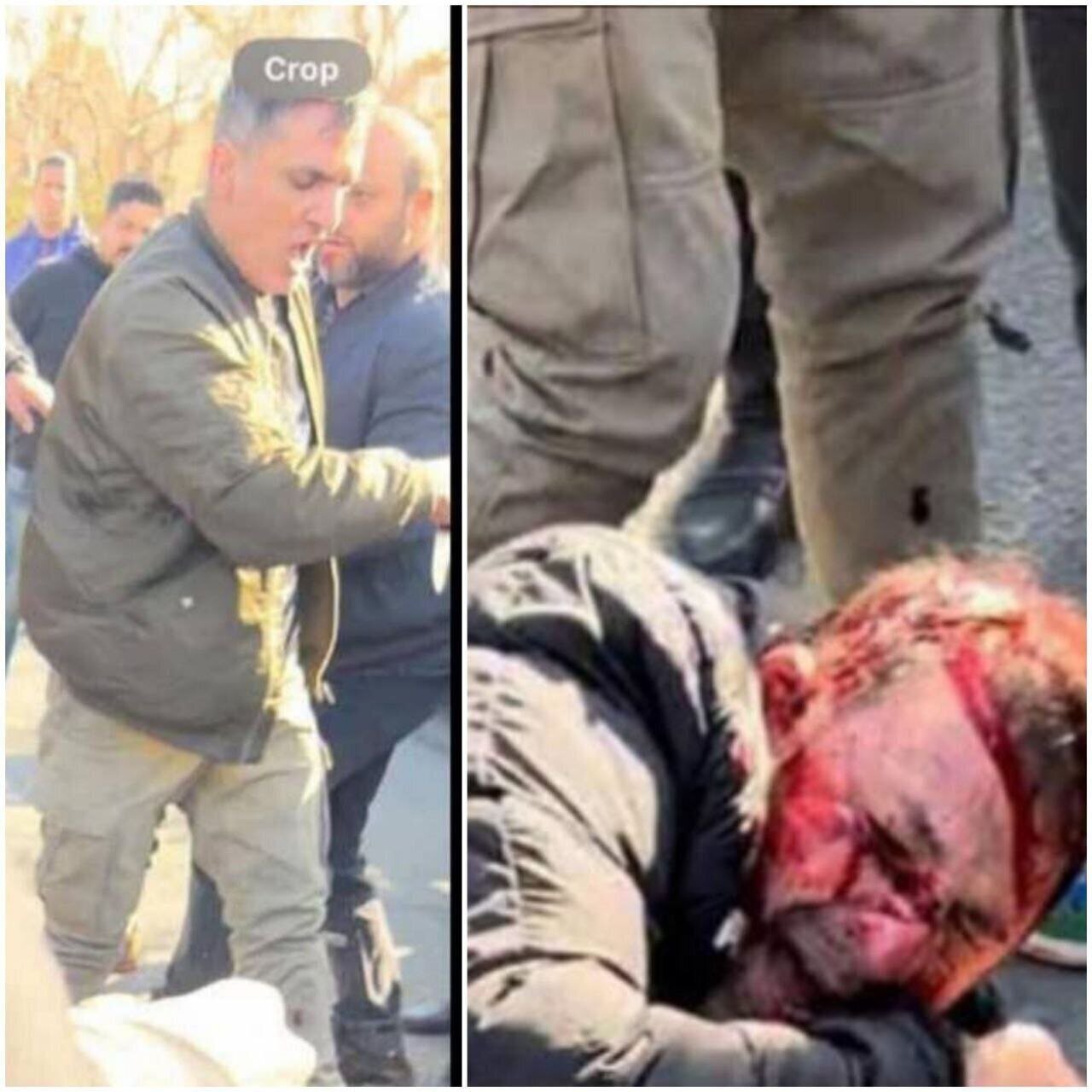 عکس | صورت خونین گندهلات تهران پس از درگیری عکس | صورت خونین گندهلات تهران پس از درگیری