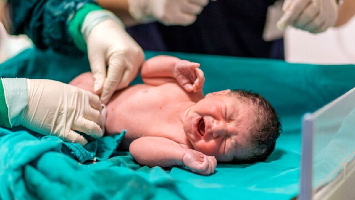 عکس | تولد نوزاد عجیبی که همه را وحشت‌زده کرد
