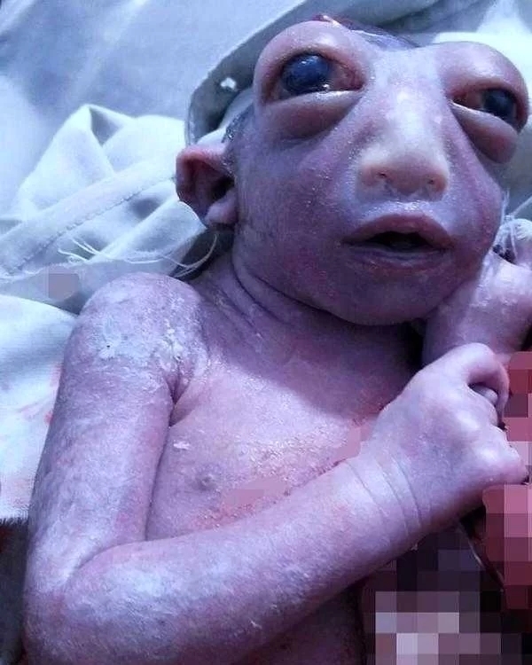 عکس | تولد نوزاد عجیبی که همه را وحشتزده کرد عکس | تولد نوزاد عجیبی که همه را وحشتزده کرد