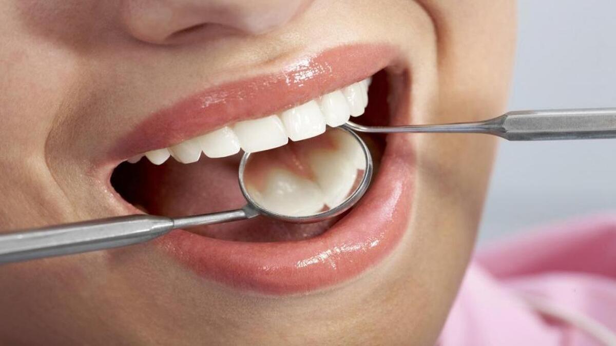گاز زدن سیب چقدر باعث پوسیدگی دندان می‌شود ؟