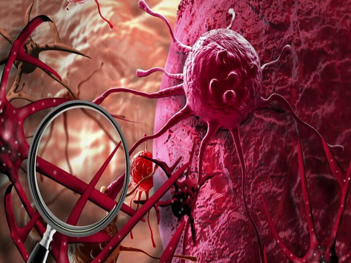 دستاورد جدید ایران در درمان سلول‌های سرطانی