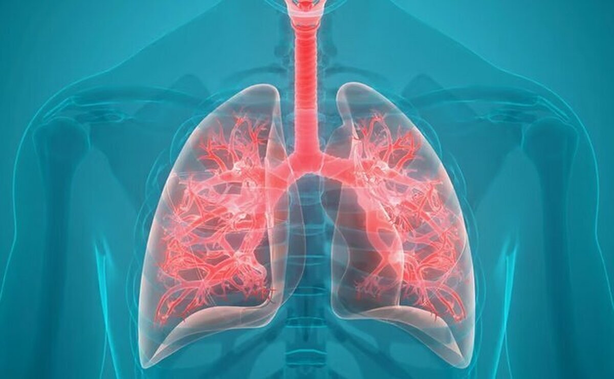 ارتباط عجیب میان سلامت لثه و ابتلا به این بیماری خطرناک تنفسی