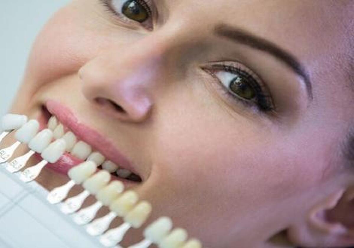 راز و رمز داشتن دندان‌های سفید | این خوارکی‌ها ، خودشان خمیردندان هستند