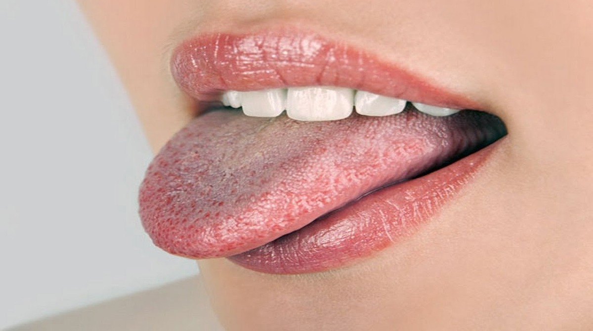 چرا زبان سفید می‌شود ؟ | از کمبود آب بدن تا نشانه اولیه برای سرطان