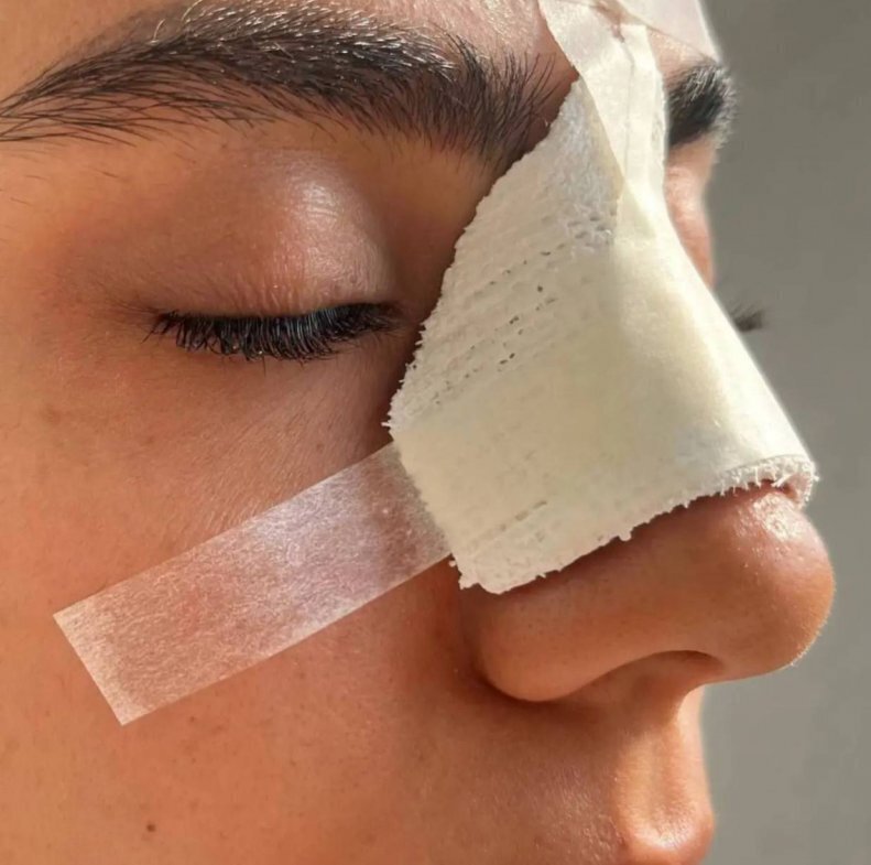 عکس | فوتبال زنان ایران بوی «خون» | گرفت سه بازیکن روانه بیمارستان شدند