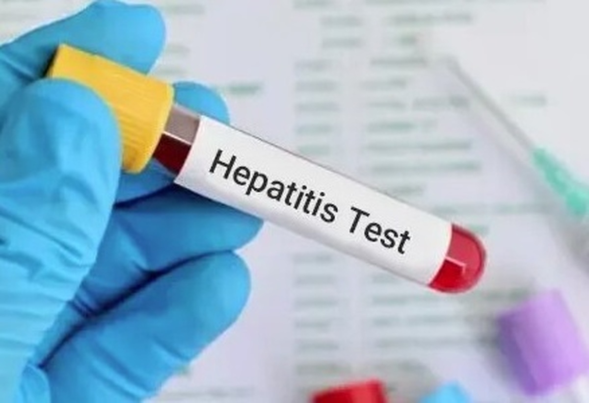 علت ابتلا به هپاتیت ویروسی چیست؟