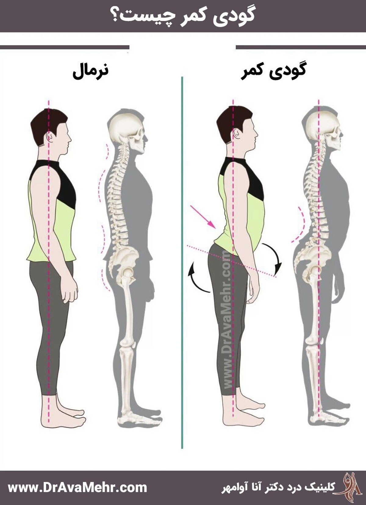 گودی کمر خود را با این روش پر کنید