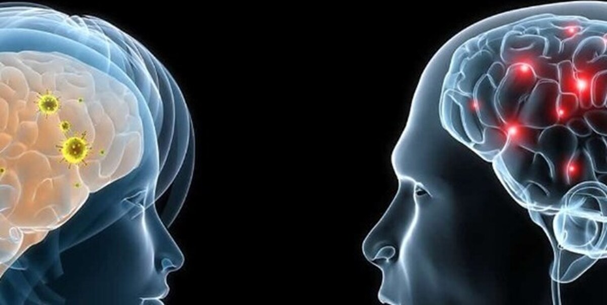 مغز مردان و زنان تفاوت دارد؟