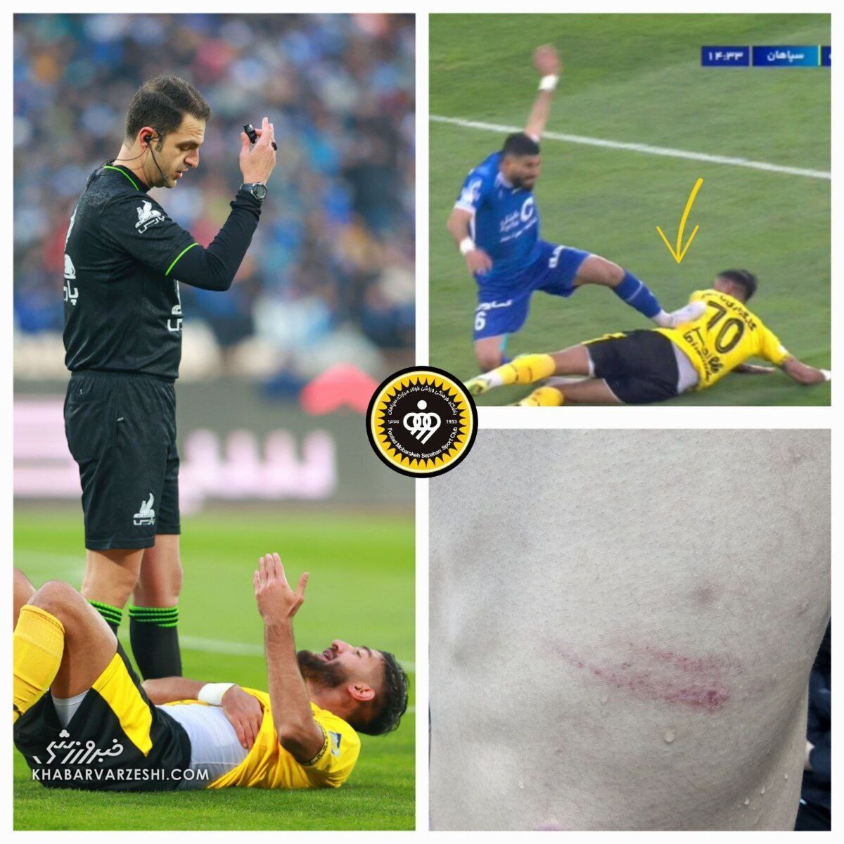 عکس | خطای خشن بازیکن استقلال روی شهریار مغانلو