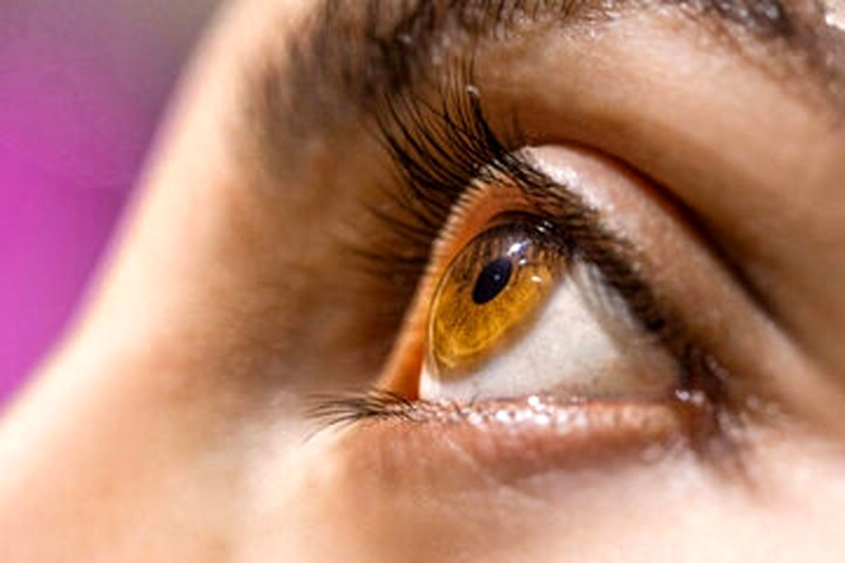 اگر این علائم را در چشم‌های خود می‌بینید؛ نگران ابتلا به این ۶ بیماری مهم باشید!