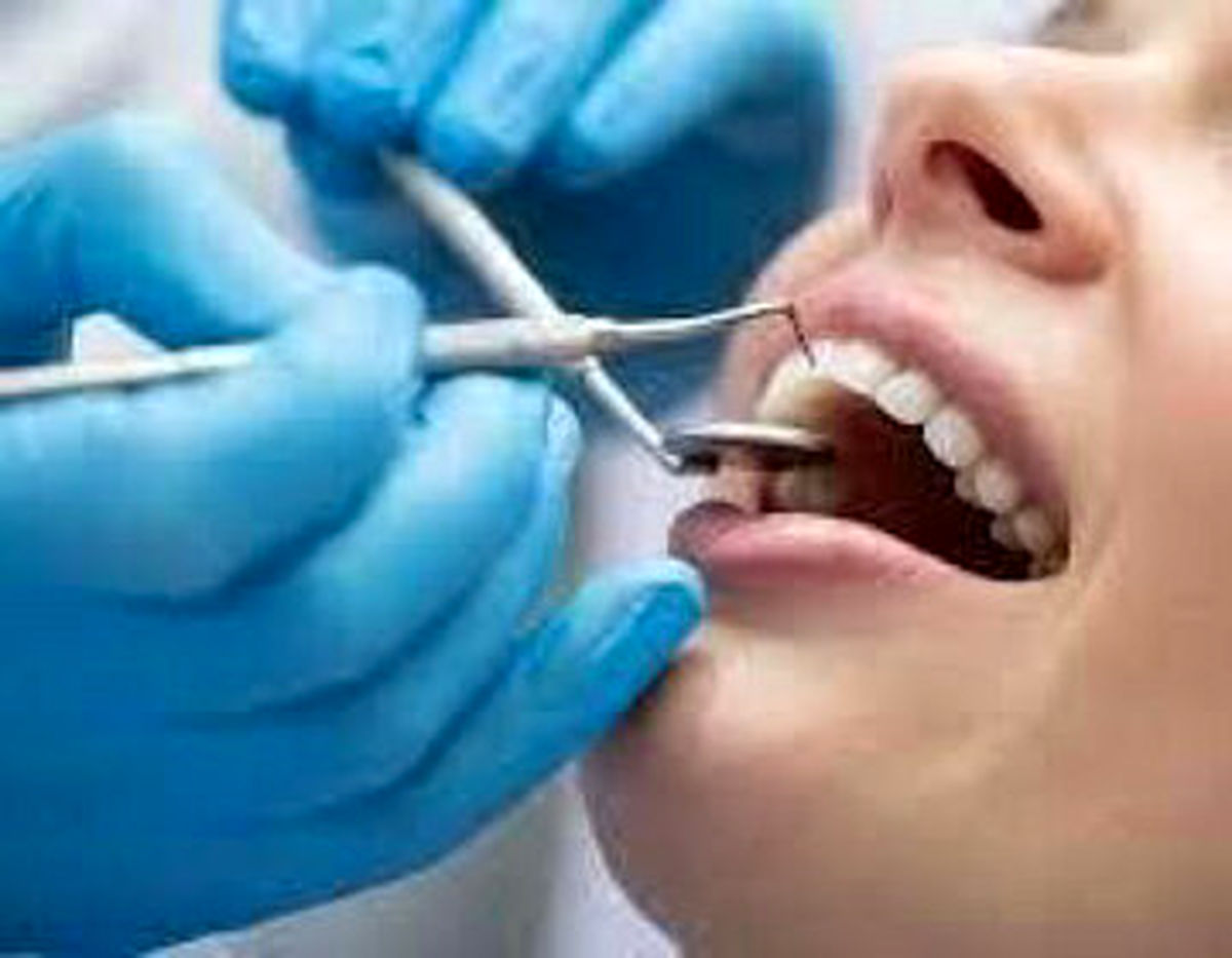 جرم‌گیری دندان خوب است یا بد؟