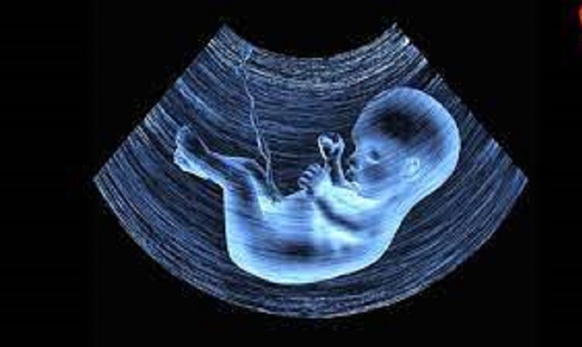 تصمیم شوکه‌کننده وزارت بهداشت | غربالگری جنین متوقف شد!