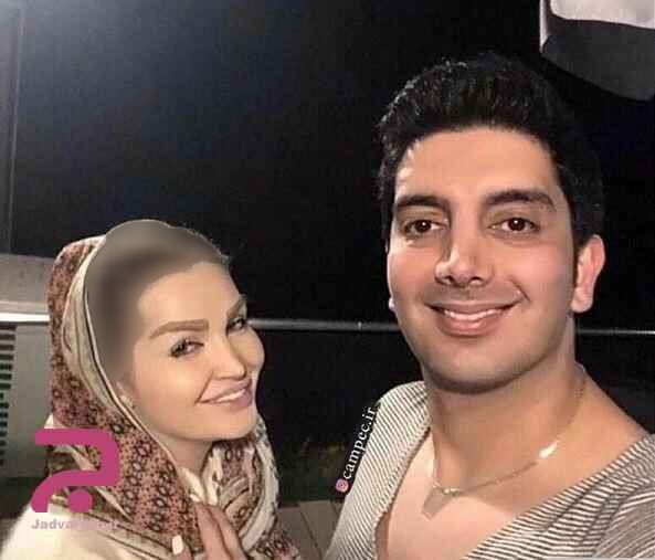 عکس | فرزاد فرزین را قبل از عملهای زیبایی عکس | فرزاد فرزین را قبل از عملهای زیبایی