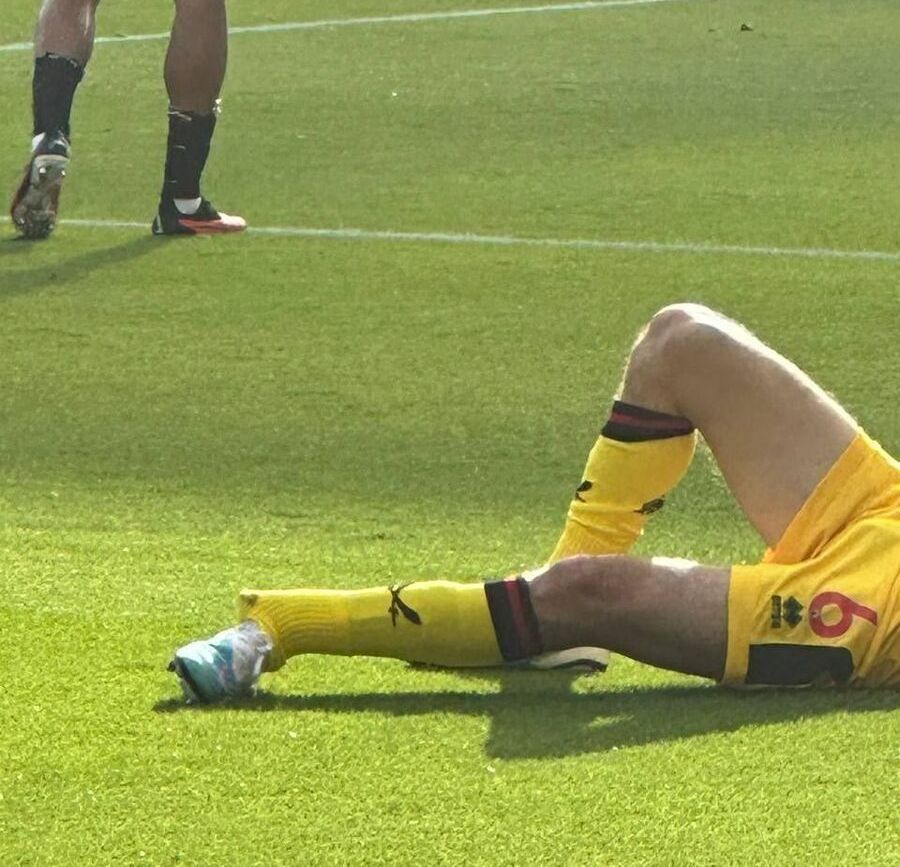 عکس | دلخراش‌ترین مصدومیت دنیای فوتبال