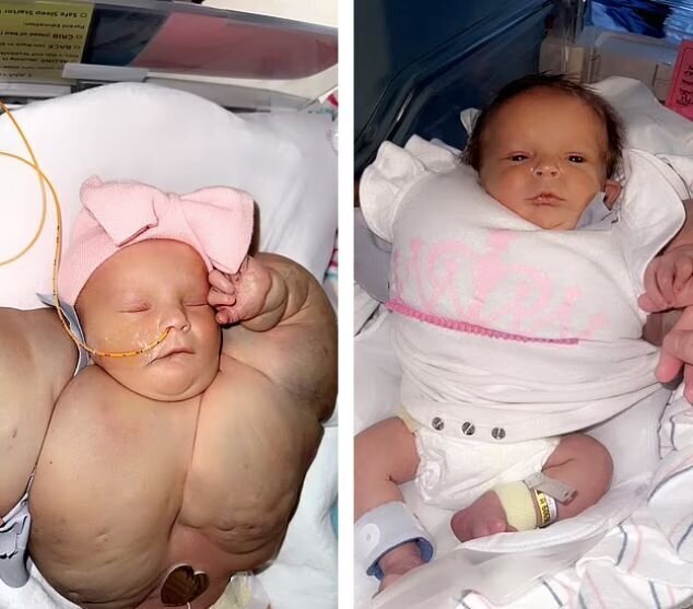 عکس | دست و بالاتنه ترسناک نوزادی که هالک متولد شد عکس | دست و بالاتنه ترسناک نوزادی که هالک متولد شد