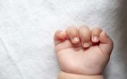 عکس | دست و بالاتنه ترسناک نوزادی که هالک متولد شد