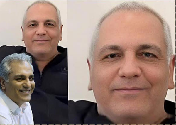 عکس شوک کننده از تغییرات در چهره و مدل موی مهران مدیری