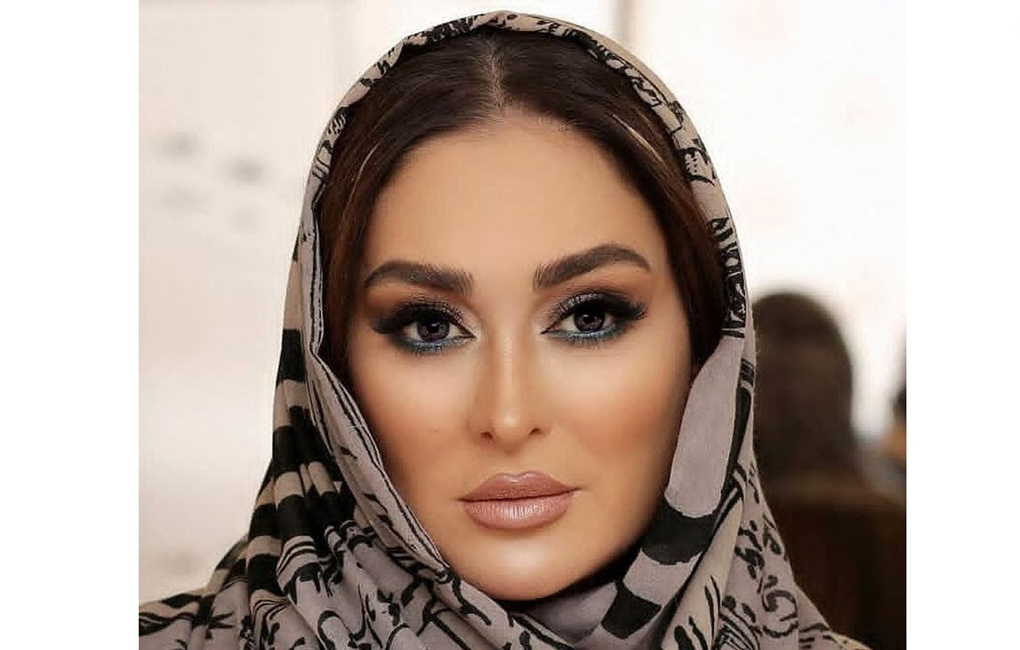 نتیجه عملهای زیبایی الهام حمیدی | شوهر دوم کوچکتر و جذابتر خانم بازیگر نتیجه عملهای زیبایی الهام حمیدی | شوهر دوم کوچکتر و جذابتر خانم بازیگر