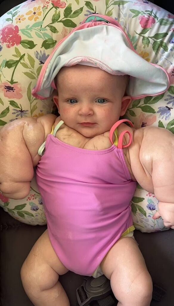 ویدیو | نوزادی که ۳۵ ساله به دنیا آمد!