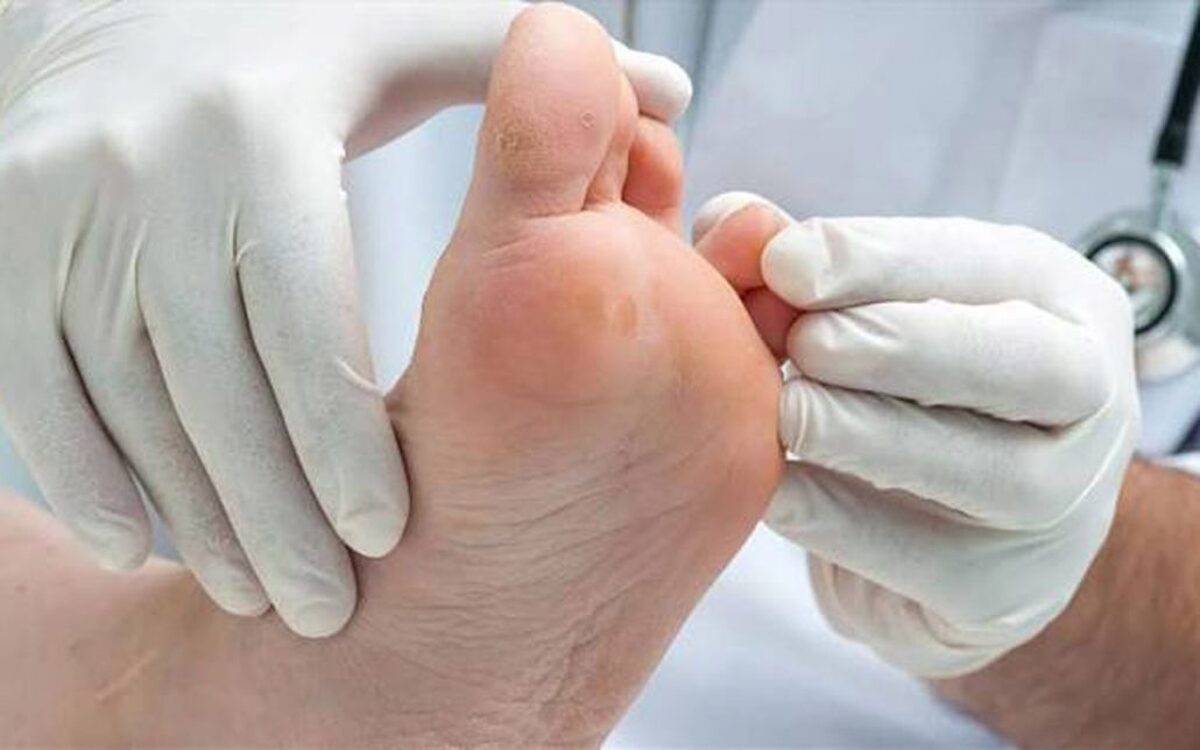 ویدیو | توصیه حیاتی به بیماران دیابتی | زخم‌های انگشتان پا را باید جدی بگیرند
