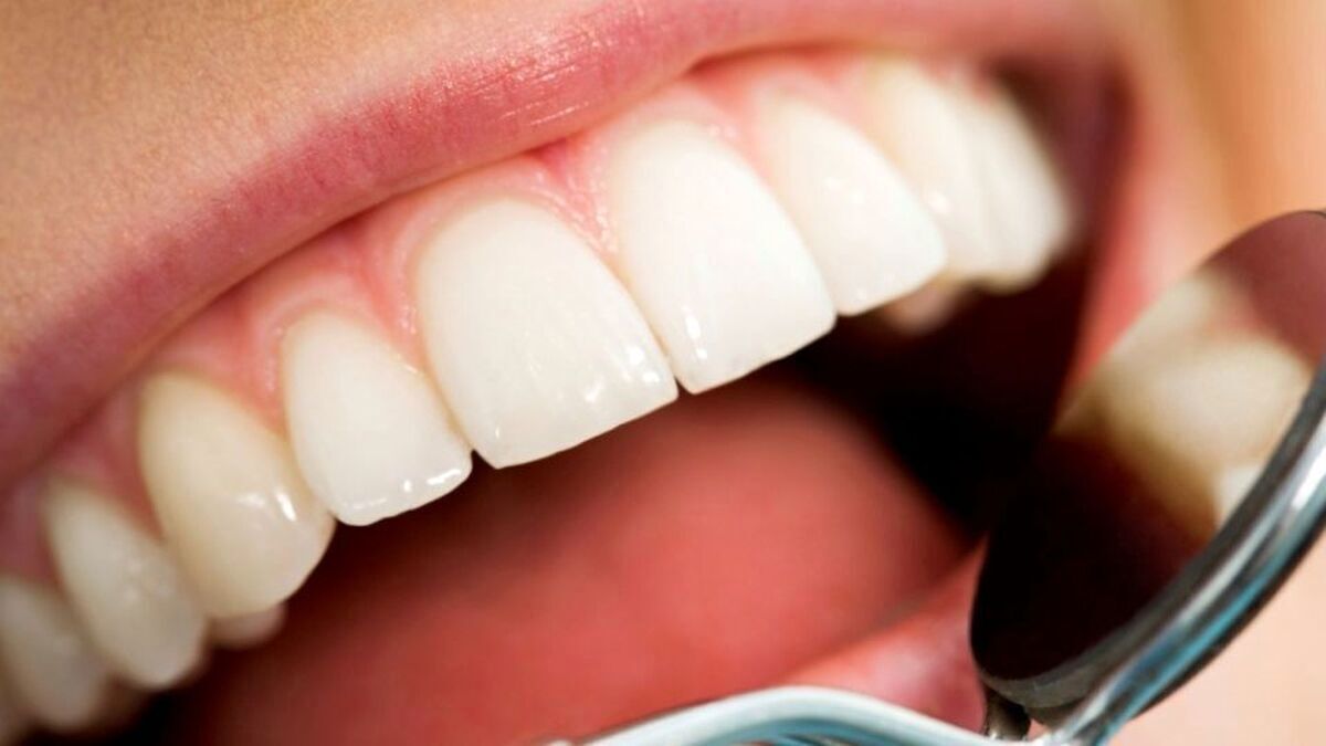 دندان‌های سالم در گرو خوردن این ویتامین‌ها