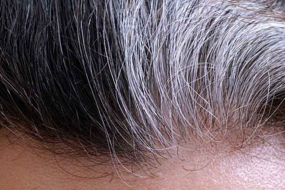 ویتامینی که از سفید شدن مو‌ها جلوگیری می‌کند