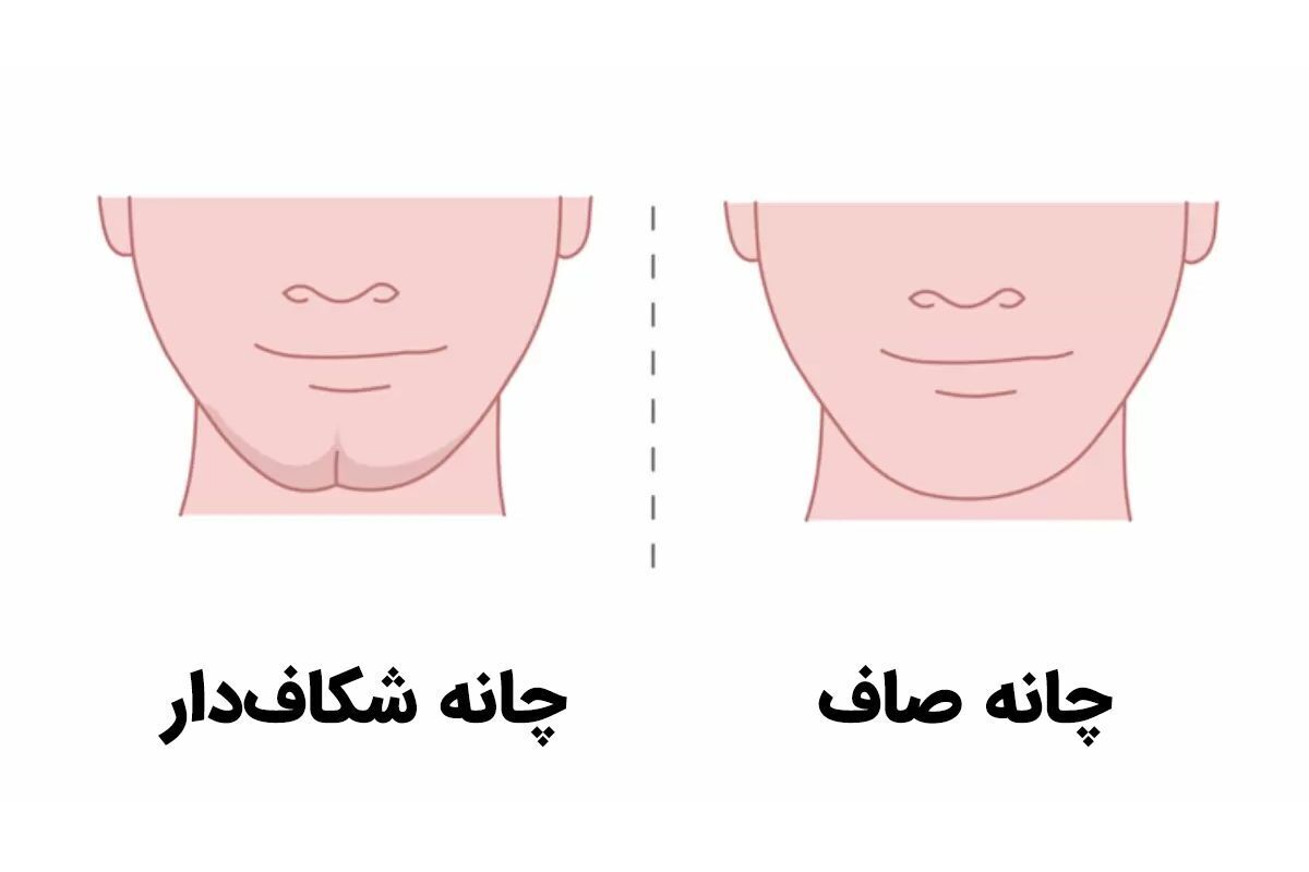 شکل چانه چه رازهای شخصیتی را افشا می‌کند ؟