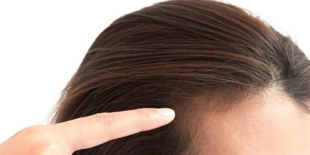 درمان ریزش مو فقط با خوردن ویتامین