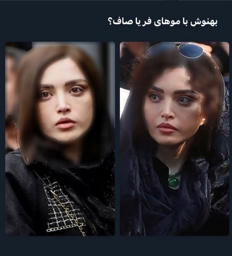 رقابت عمل‌های زیبایی بین بازیگران ایرانی!