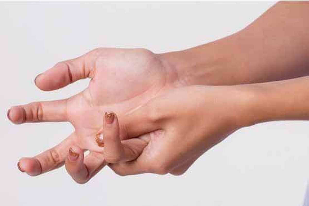 آرتروز دست و دردهای آن را با این روش کنترل کنید