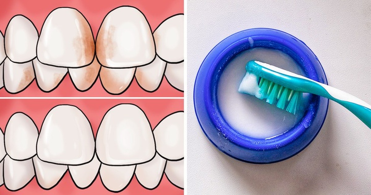 راهکار‌هایی ساده برای داشتن دندان‌هایی سالم‌تر و زیباتر