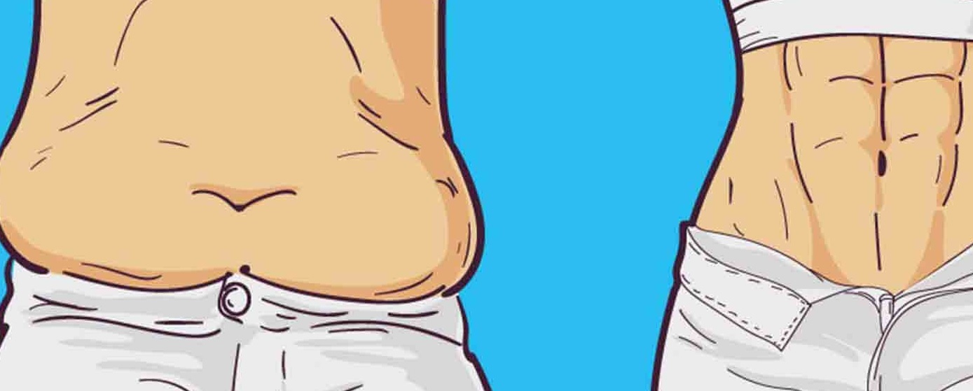 هزینه عمل ابدومینوپلاستی در سال 1403 و عوامل موثر بر آن