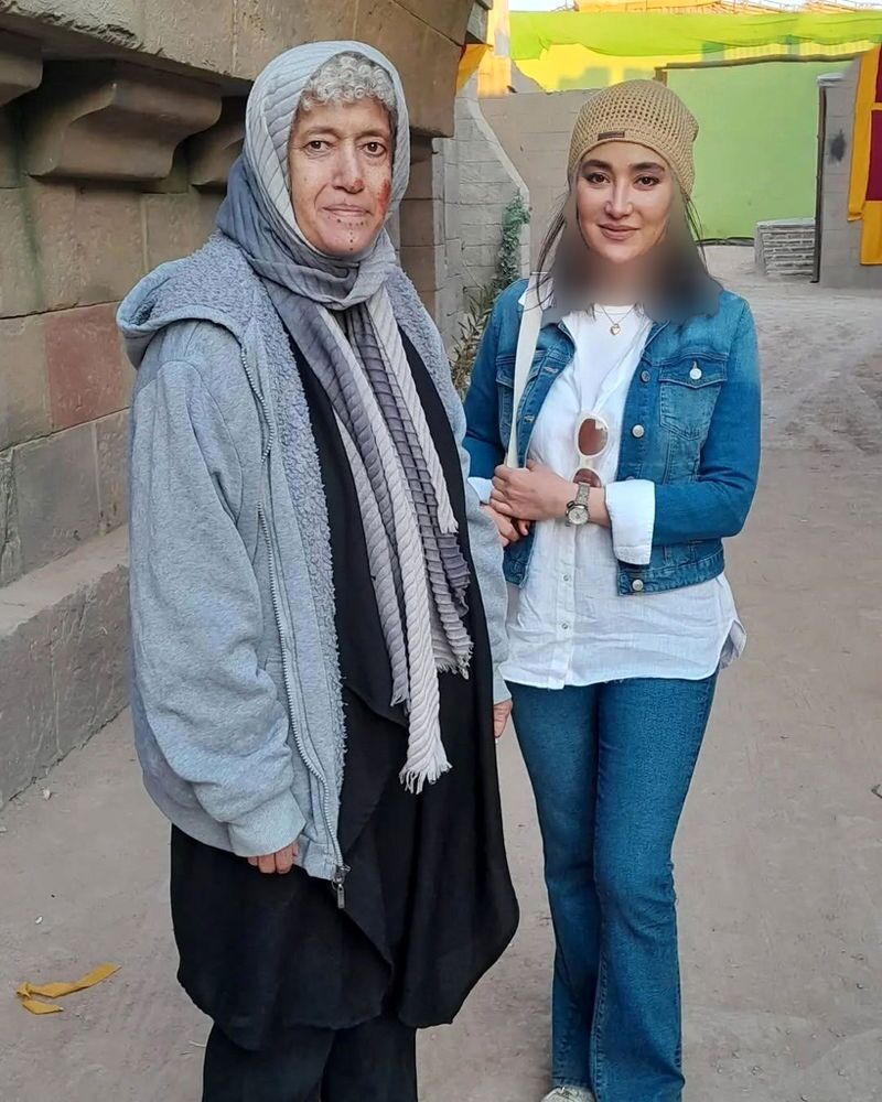 عکس | تغییرات چهره بهاره افشاری در ۴۰ سالگی عکس | تغییرات چهره بهاره افشاری در ۴۰ سالگی