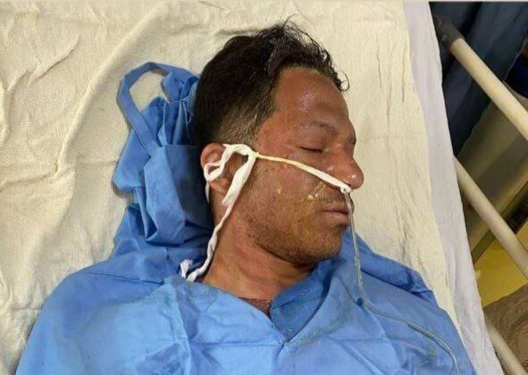 عکس | تصویری دلخراش از سوختگی زیاد بازیکن سابق پرسپولیس عکس | تصویری دلخراش از سوختگی زیاد بازیکن سابق پرسپولیس