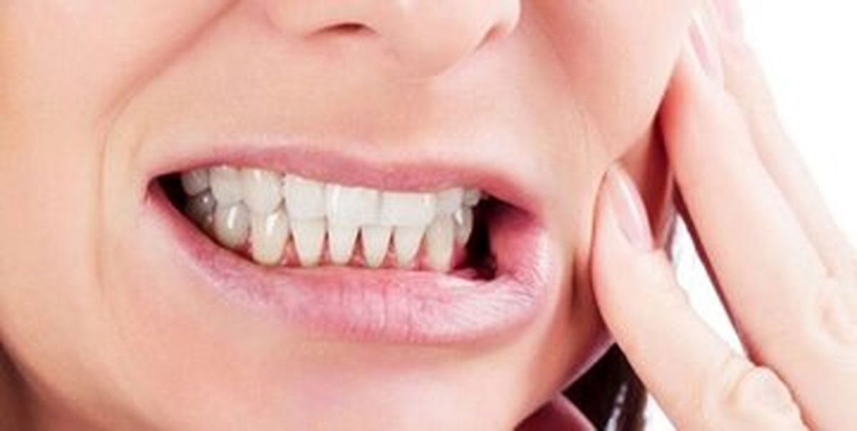 خوردن موز دندان‌های شما را خراب می‌کند
