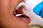 ارتباط مهم سلامت مغز با سلامت دهان و دندان