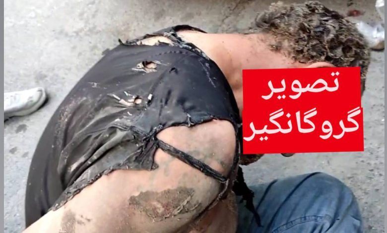 فوری | جزئیات هولناک درباره گروگانگیری که امروز خود و گروگان ها را در تهران به آتش کشید + تصویری از وضعیت وخیم گروگانگیر