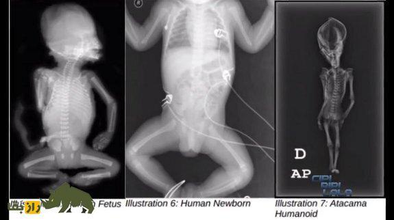 مومیایی عجیب الخلقه آتاکاما مرموزترین معمای جهان شد | اسکلت ترسناک ۱۵ سانتیمتری آتا مومیایی عجیب الخلقه آتاکاما مرموزترین معمای جهان شد | اسکلت ترسناک ۱۵ سانتیمتری آتا