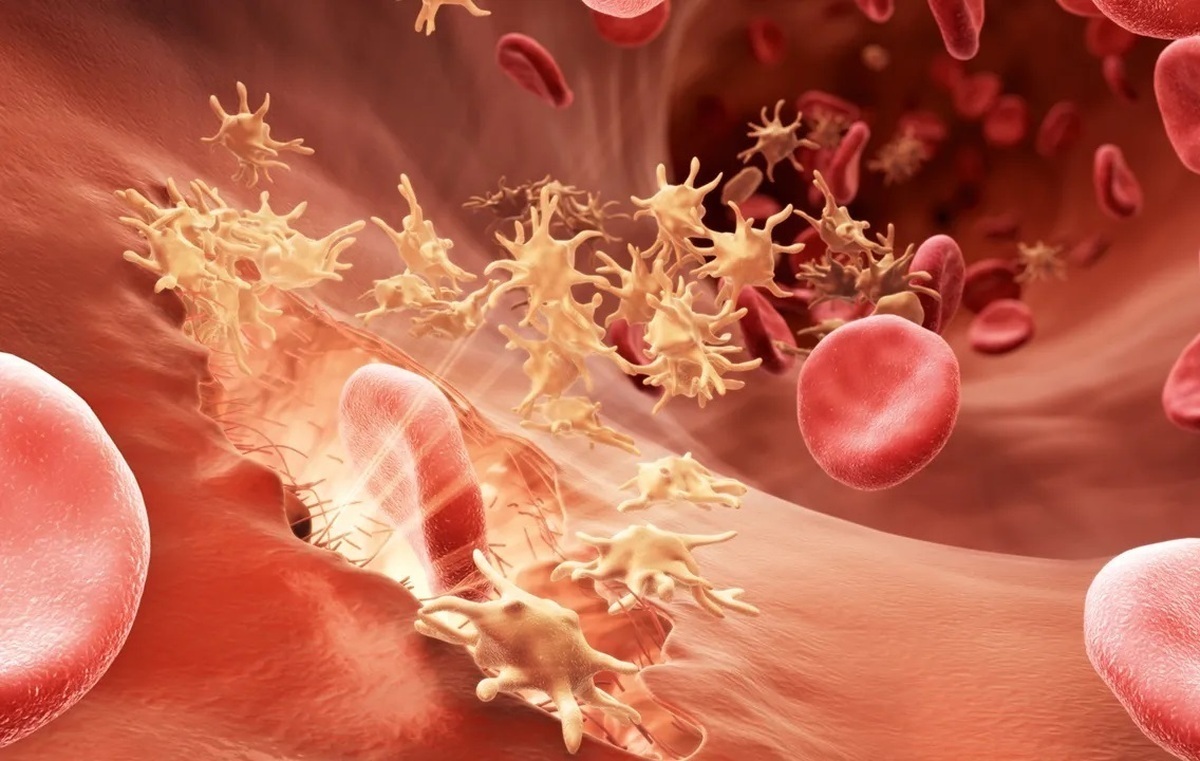 چند ترفند درمانی برای افزایش پلاکت‌های خون + علت و علائم