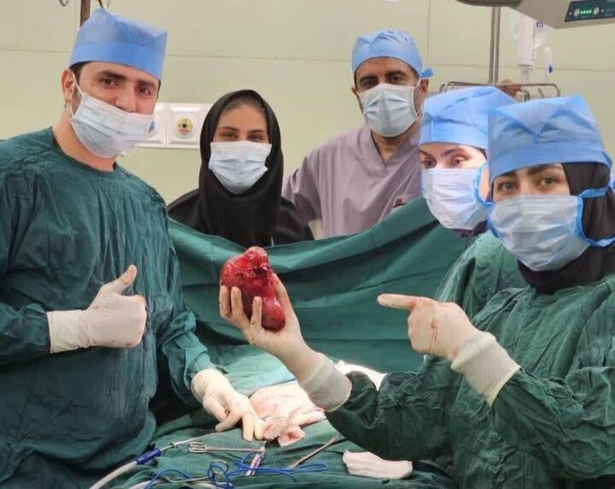 بزرگترین جراحی در بدن کودک بندرعباسی | تومور ۱۴ سانتی از کلیه کودک خارج شد